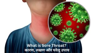 Read more about the article गले में इन्फेक्शन के लक्षण, कारण और उपचार – Sore Throat In Hindi